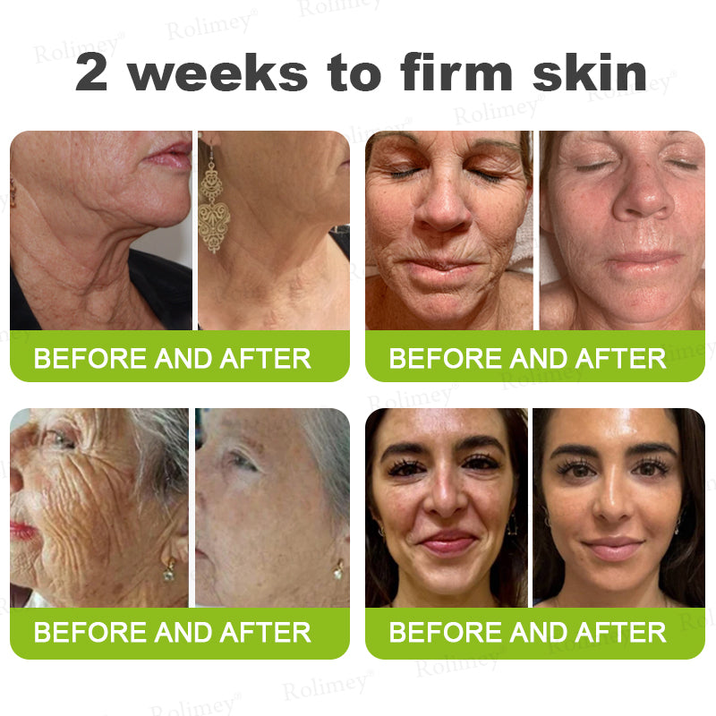 💎Made and shipped from the USA Rolimey® Botox & Vita-A Retinol Shot Wrinkle-Lift Tightening cream - Last Day Promotion 70% OFF