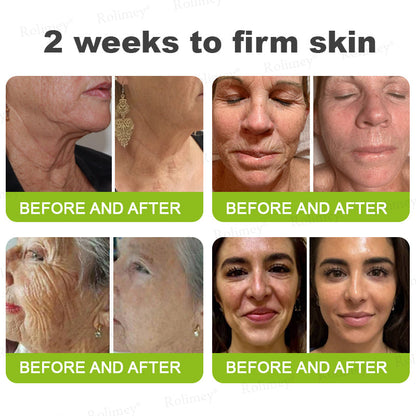 💎Made and shipped from the USA Rolimey® Botox & Vita-A Retinol Shot Wrinkle-Lift Tightening cream - Last Day Promotion 70% OFF