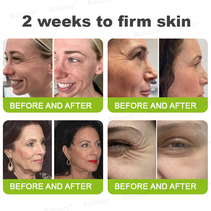 💎Made and shipped from the USA Rolimey® Botox & Vita-A Retinol Shot Wrinkle-Lift Tightening cream - Last Day Promotion 70% OFF