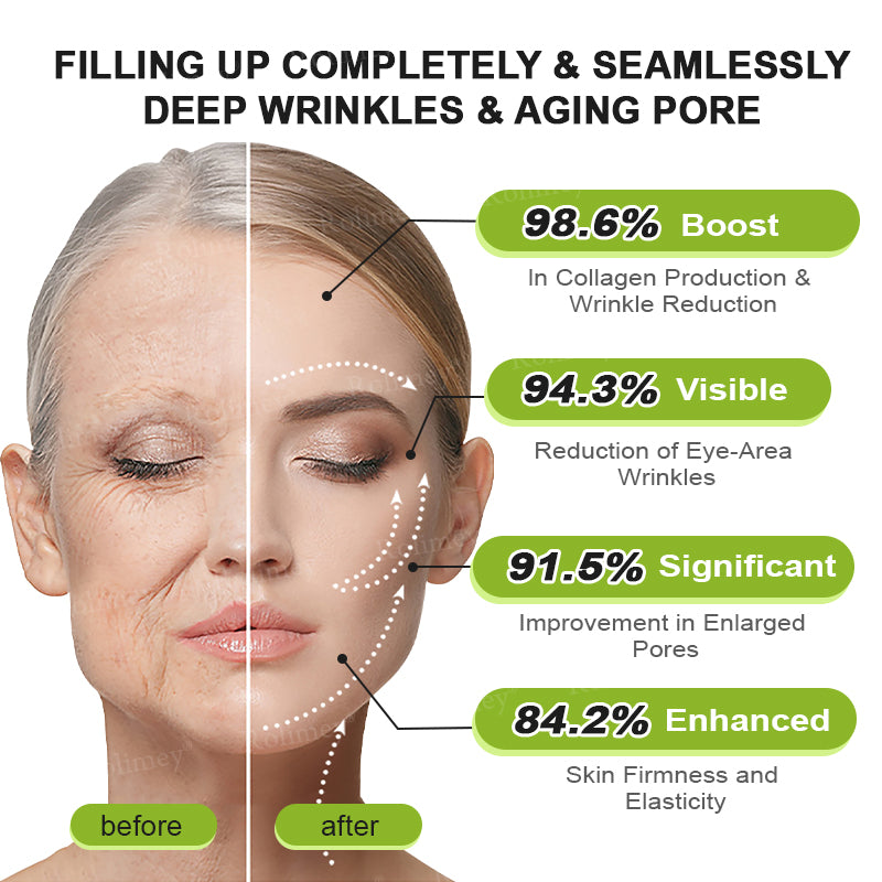 💎Made and shipped from the USA Rolimey® Botox & Vita-A Retinol Shot Wrinkle-Lift Tightening cream - Last Day Promotion 70% OFF