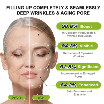 💎Made and shipped from the USA Rolimey® Botox & Vita-A Retinol Shot Wrinkle-Lift Tightening cream - Last Day Promotion 70% OFF