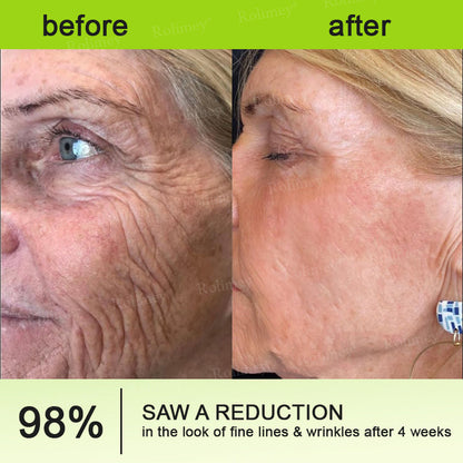 💎Made and shipped from the USA Rolimey® Botox & Vita-A Retinol Shot Wrinkle-Lift Tightening cream - Last Day Promotion 70% OFF