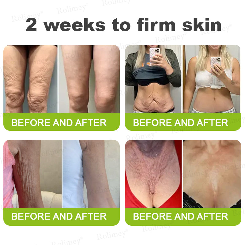 💎Made and shipped from the USA Rolimey® Botox & Vita-A Retinol Shot Wrinkle-Lift Tightening cream - Last Day Promotion 70% OFF