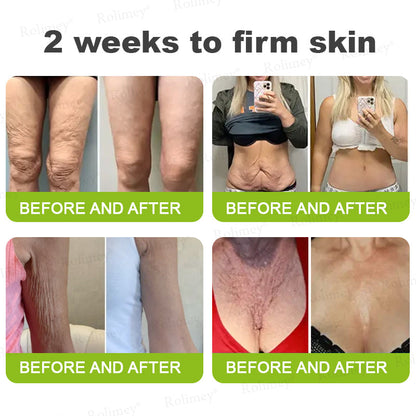 💎Made and shipped from the USA Rolimey® Botox & Vita-A Retinol Shot Wrinkle-Lift Tightening cream - Last Day Promotion 70% OFF